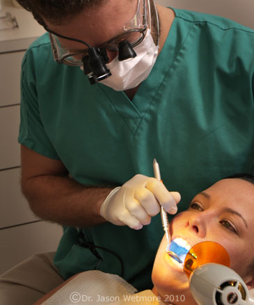 placing a white composite resin filling in a cavity